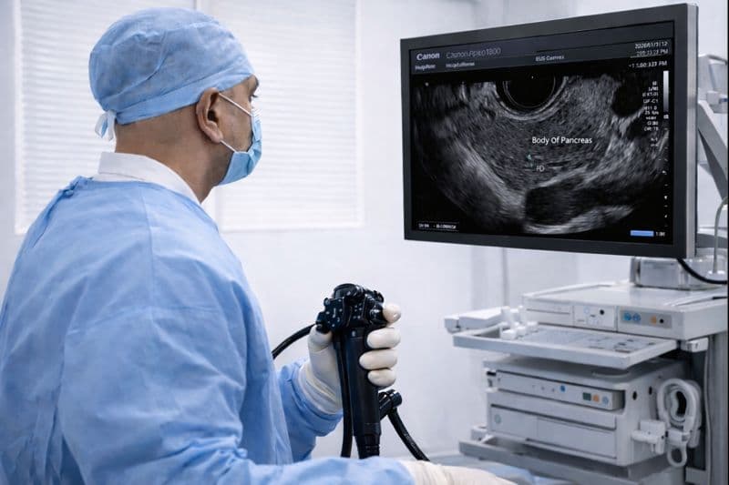 Endoscopic Ultrasound procedure