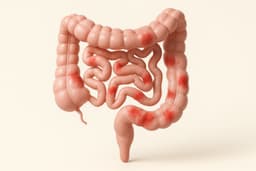 Inflammatory Bowel Disease